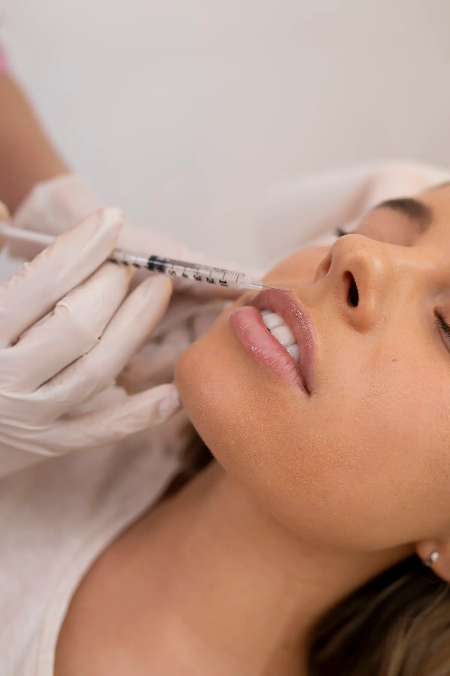 Tratamiento de relleno de labios a una chica