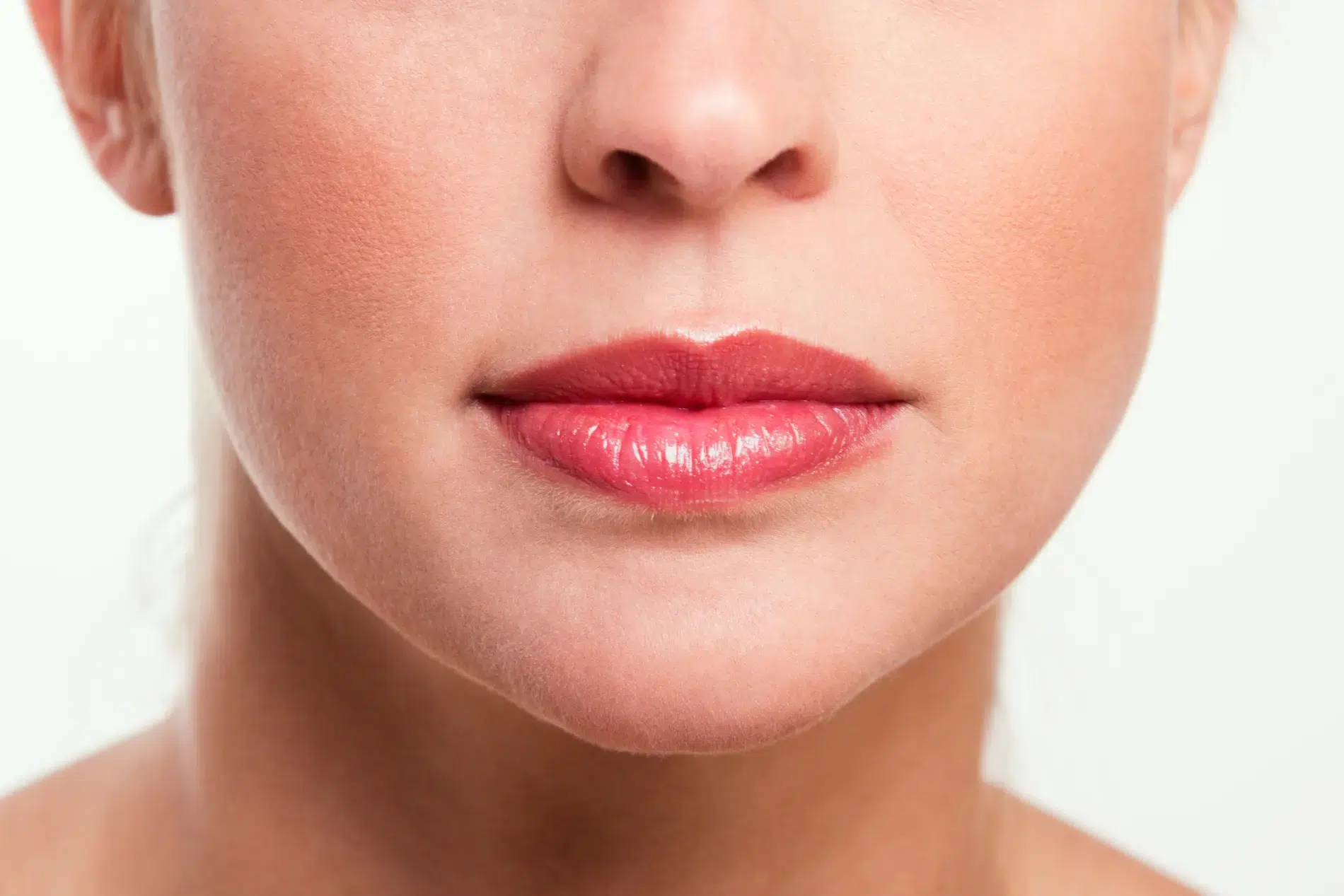 Relleno de Labios: Lo que Necesitas Saber sobre el Procedimiento y las Opciones Disponibles 4 Resultado de chica relleno de labios