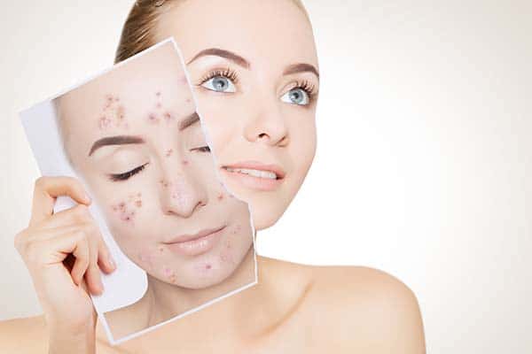 Fototerapia LED: Innovación en el Tratamiento de Manchas y Textura de la Piel en Medicina Estética 2 curso fototerapia